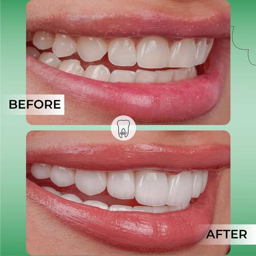 Dental Procedure